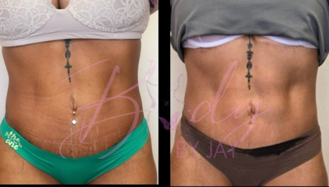 Weight loss injection Burleson