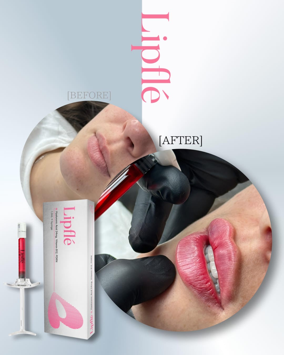 In Stock Will Ship Same Day!Lipfle- Color Lip Serum Tesero Alternative. (1.2ml syringe)