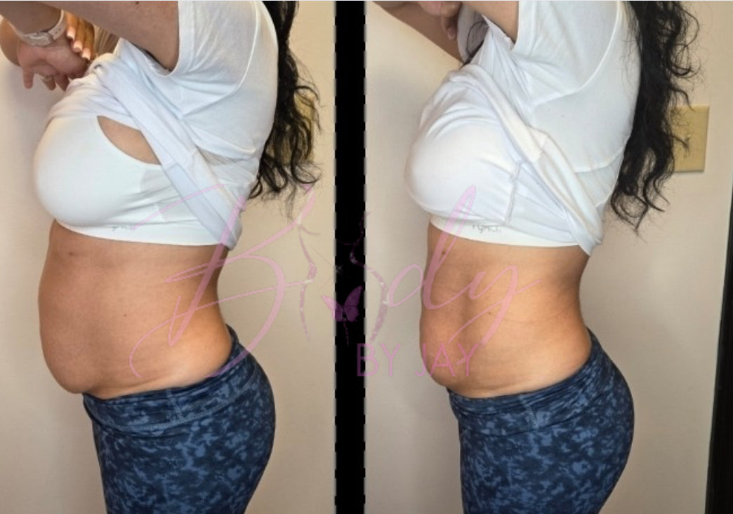 Ems muscle stimulation