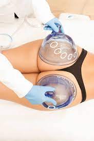 Non-Invasive Brazilian Butt Lift - Enhance Curves with Vacuum Therapy & Optional Serum for Firmness