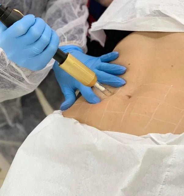 No-Needle Fat Dissolver Lipo Shots with Hyaluron Pen - Virtual Mesotherapy for Safe Body Contouring